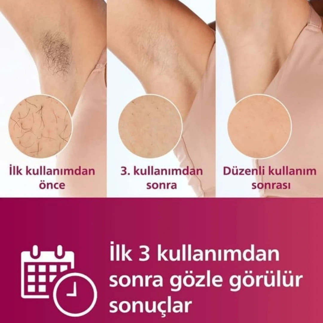 Philips Epilasyon Sistemi – Pürüzsüz Cilt için Profesyonel Çözüm